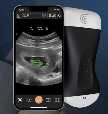 Clarius Mobile Health has announced that is has obtained U.S. Food and Drug Administration (FDA) clearance for the Clarius OB AI fetal biometric measurement tool.