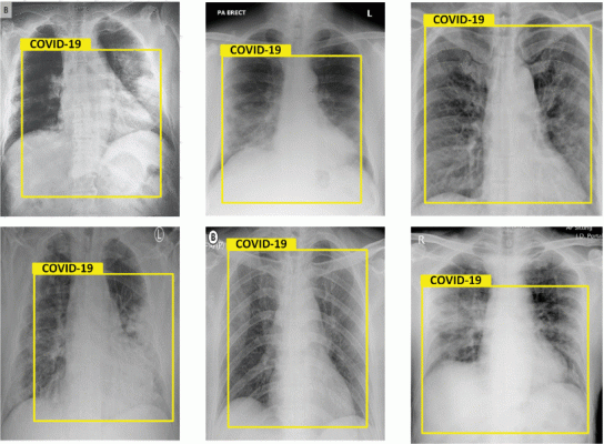 AI in the Fight Against COVID-19: Automatic Detection from Chest X-Ray  Images Is Possible, Reports Incheon National University