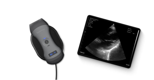 EagleView Portable Wireless Ultrasound Scanner with Linear, Convex