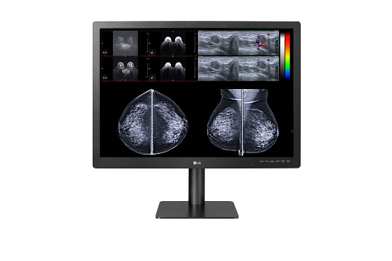 lg dicom monitor