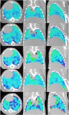 In vivo ventilation/perfusion (V/Q) imaging