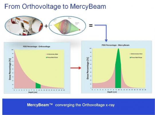 Convergent R.N.R Mercy Beam Technology Radiation Therapy