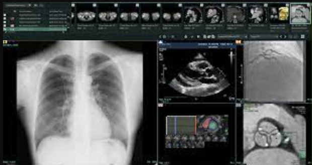 Synapse 3D Medical Imaging  Fujifilm Healthcare Solutions