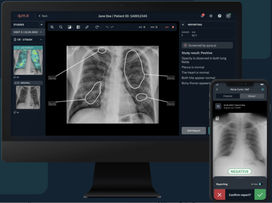 More than 1,700 US radiologists to gain easier access to the latest imaging AI solutions to drive radiology efficiency, clinical quality and patient care 