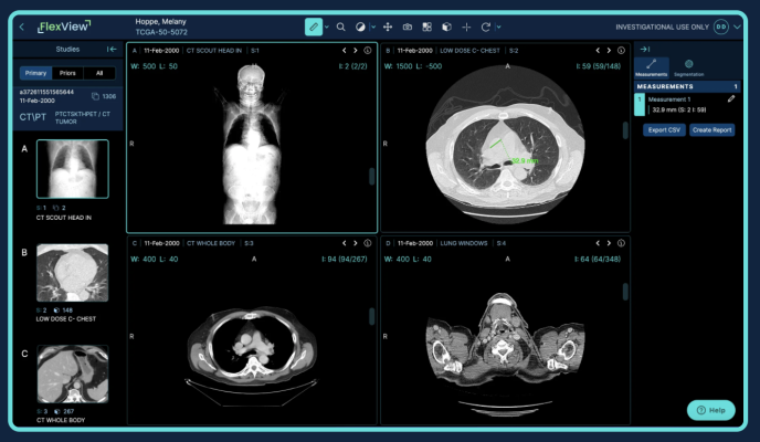 Visage Imaging, Inc., a wholly owned subsidiary of Pro Medicus Ltd., has announced it will showcase new product enhancements and innovations for the industry-leading Visage 7 Enterprise Imaging Platform