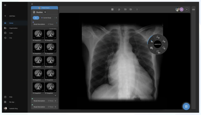 Radiologists can now save significant time and accelerate clinical output through the automated creation of patient-specific reports