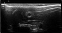 Ultrasound chitosan nerve conduit rat model sciatic nerve defects 