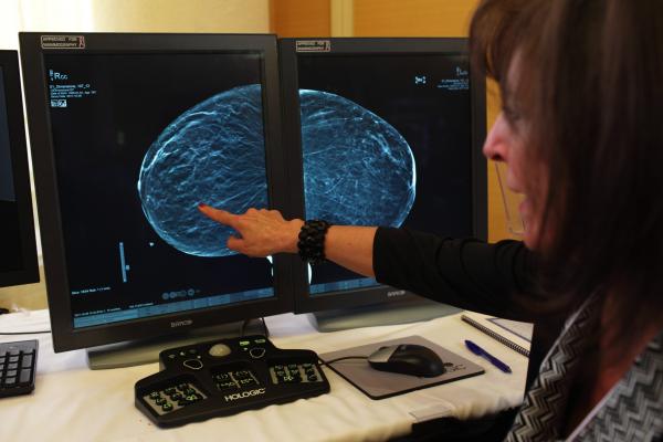 Mammography Market Value in the Americas Projected Beyond $1 Billion by 2020