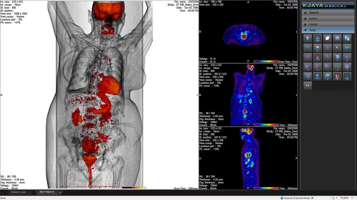 SNMMI Publishes New FDG PET/CT Appropriate Use Criteria | Imaging