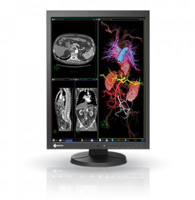 eizo medical monitor