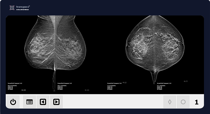 Women's Wellness: Molecular breast imaging - Mayo Clinic News Network