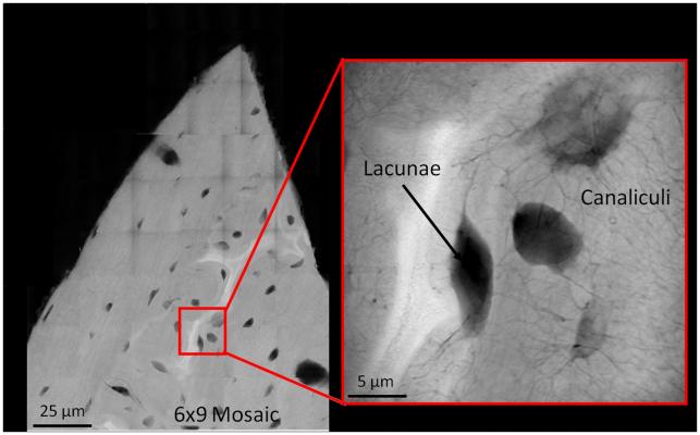 X-Ray Imaging Cornell University Research Bone Fractures Cracks