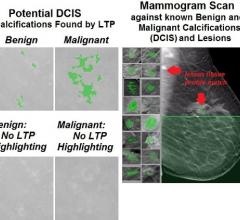 mammography, women's health