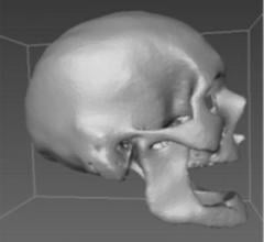 NCSU CT systems