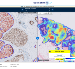 Proscia has announced an update to its AI-enabled cloud-based workflow solution, advancing digital pathology.
