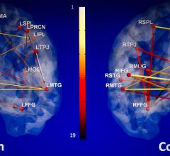 mri systems clinical trials study university alabama auburn psychology autism