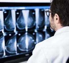 Study Suggests Breast Cancer Patients Forego Post-Surgery Treatment Due to Mistrust