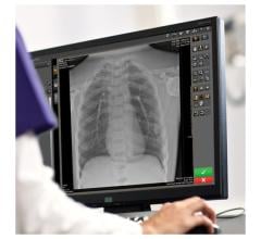 Carestream launches its Image Suite MR 10 Software to help deliver a boost to productivity and efficiency while enabling a more user-friendly imaging experience for radiographers.