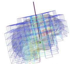 Stéphane Bordas, Professor in Computational Mechanics at the Faculty of Science, Technology and Communication of the University of Luxembourg, and his team have developed methods to train surgeons, help them rehearse for such complex operations and guide them during surgery