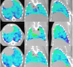 In vivo ventilation/perfusion (V/Q) imaging