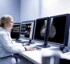 USPSTF, breast cancer screening recommendations, ACR, SBI