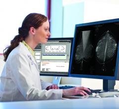 mammography breast density