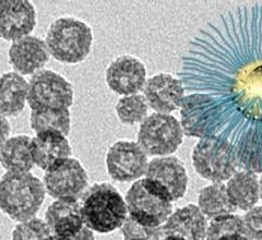 The novel nanoparticle is designed to enhance radiation killing of cancer cells in the radiation resistant low-oxygen tumor core