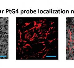 The luminescent oxygen probe PtG4 is injected during the week of radiation treatment and localizes between the cells of the tumor as illustrated by microscopy