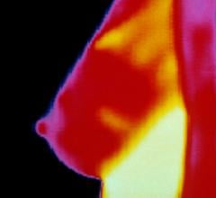 FDA Cracks Down on Thermography