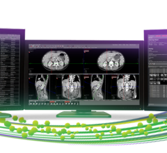 Visage Imaging, Inc., a wholly owned subsidiary of Pro Medicus Ltd., has announced it will showcase new product enhancements and innovations for the industry-leading Visage 7 Enterprise Imaging Platform