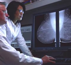 digital mammography, age 50, risks, radiation-induced breast cancer, Annals of Internal Medicine