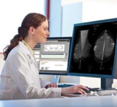 digital breast tomosynthesis, Time, leading healthcare advances, 2014, DBT