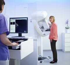 Philips, California, UC Irvine, mammography, breast cancer, Microdose SI