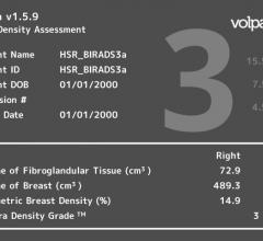 Karolinska Study VolparaDensity Mammography Systems 