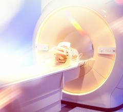 New Targets for Radiation Therapy Include Cardiac AF Ablations and