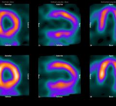 Hybrid Imaging: The Best of Both Worlds