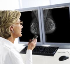 Mammography on the Road to Integration