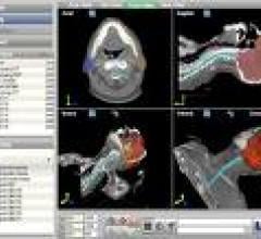 OncoView is an oncology-specific image management and storage solution that integrates images from diagnosis to radiation therapy, and in the same view provides data on the location where dose was delivered in a follow-up exam.