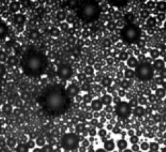 The microbubbles that make up the ultrasound contrast agent Optison.