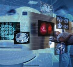 How AI provides much needed support for healthcare professionals