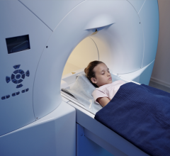 Why treat with Radiotherapy upright? — Leo Cancer Care