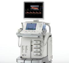 Emerging Trends in Ultrasound Imaging, Toshiba's Aplio 500