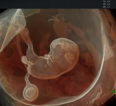  New Ultrasound Scanner Gives 4-D Image 