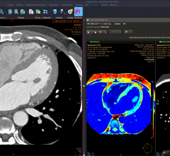 Philips integrated the IntelliSpace Portal advanced applications with the Philips diagnostic viewer (from Carestream)  creating a combined radiology diagnostic workspace.