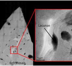 X-Ray Imaging Cornell University Research Bone Fractures Cracks