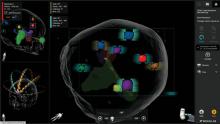 Brainlab Elements, ASTRO, radiation therapy