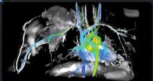 GE Healthcare's ViosWorks cardiac MRI analysis software.