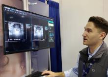 In a demonstration on the exhibit floor of the SBI symposium, Koios software identified suspicious lesions in ultrasound images