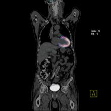 pet scans