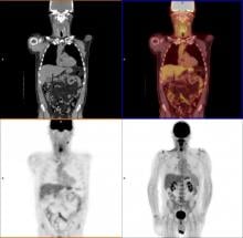 PET, PET imaging, PET-CT, FDG PET, PET cancer assessment, pet scanner, nuclear imaging, molecular imaging